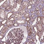 ZNF630 Antibody in Immunohistochemistry (Paraffin) (IHC (P))