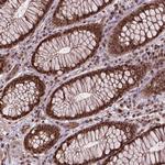 ZNF630 Antibody in Immunohistochemistry (Paraffin) (IHC (P))