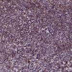 ZNF630 Antibody in Immunohistochemistry (IHC)