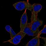 GAB2 Polyclonal Antibody