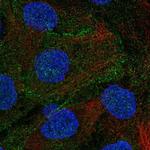 DLG5 Polyclonal Antibody