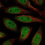 ALX4 Polyclonal Antibody