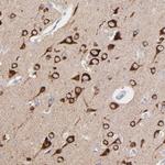 PSD3 Antibody in Immunohistochemistry (Paraffin) (IHC (P))