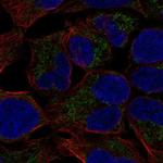 MCAT Polyclonal Antibody