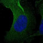 Asparagine Synthetase Polyclonal Antibody