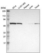 TROVE2 Antibody in Western Blot (WB)