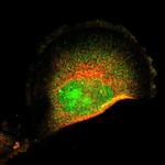 FRMD8 Polyclonal Antibody