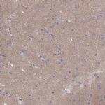 CACNG4 Antibody in Immunohistochemistry (IHC)