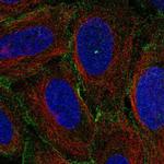 MYO1C Polyclonal Antibody