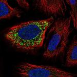 ZNF230 Polyclonal Antibody