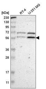 ZNF230 Antibody in Western Blot (WB)