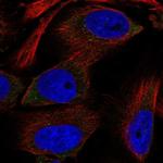 RPS12 Polyclonal Antibody