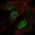 HOXA11 Polyclonal Antibody