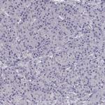 SLC18A1 Polyclonal Antibody