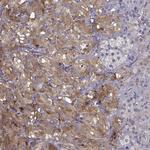 SLC18A1 Antibody in Immunohistochemistry (IHC)