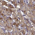 SLC18A1 Antibody in Immunohistochemistry (IHC)