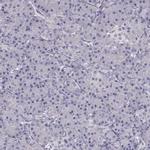 SLC18A1 Antibody in Immunohistochemistry (IHC)