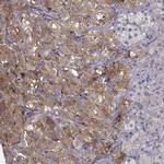 SLC18A1 Antibody in Immunohistochemistry (IHC)