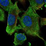 HECW1 Polyclonal Antibody