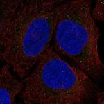 Serine racemase Polyclonal Antibody