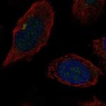 B4GALT2 Polyclonal Antibody