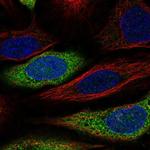 CAPZA2 Polyclonal Antibody