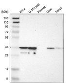 CAPZA2 Antibody in Western Blot (WB)