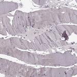 PLCB4 Antibody in Immunohistochemistry (Paraffin) (IHC (P))