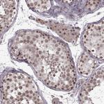 PLCB4 Antibody in Immunohistochemistry (Paraffin) (IHC (P))