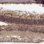 PLCB4 Antibody in Immunohistochemistry (IHC)