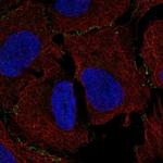 MAGI3 Polyclonal Antibody
