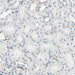 IMPG2 Antibody in Immunohistochemistry (Paraffin) (IHC (P))