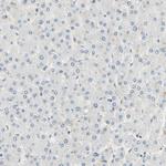 IMPG2 Antibody in Immunohistochemistry (Paraffin) (IHC (P))