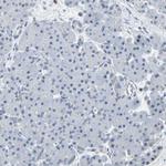 IMPG2 Antibody in Immunohistochemistry (Paraffin) (IHC (P))