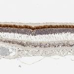 IMPG2 Antibody in Immunohistochemistry (Paraffin) (IHC (P))