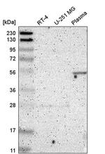 FBXL6 Antibody in Western Blot (WB)