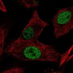 MGAT5B Polyclonal Antibody