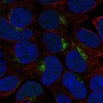 KCT2 Polyclonal Antibody