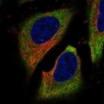 FAM134B Antibody in Immunocytochemistry (ICC/IF)