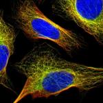 FBXO30 Polyclonal Antibody