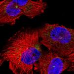 DDX26B Polyclonal Antibody