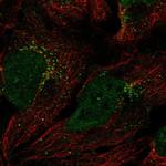 GGT7 Polyclonal Antibody