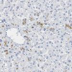 Opsin Blue Antibody in Immunohistochemistry (IHC)