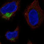 TMCO4 Polyclonal Antibody