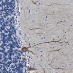 Connexin 46 Polyclonal Antibody