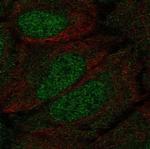 DCLK1 Polyclonal Antibody