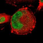 ZNF367 Polyclonal Antibody