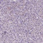 NEUROD4 Polyclonal Antibody