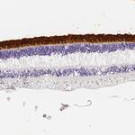 IMPG2 Polyclonal Antibody