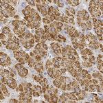 MGARP Antibody in Immunohistochemistry (IHC)